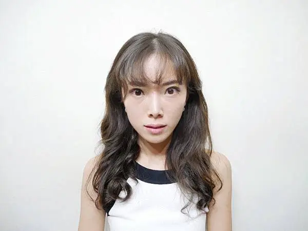 Ulthera極線音波拉提術前