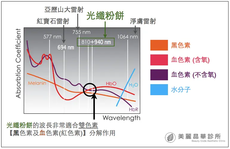 光纖粉餅雷射治療原理解析
