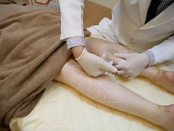 肉毒瘦小腿治療過程