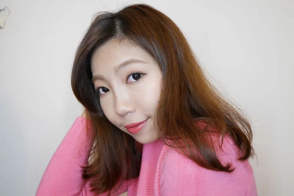 玻尿酸淚溝術後