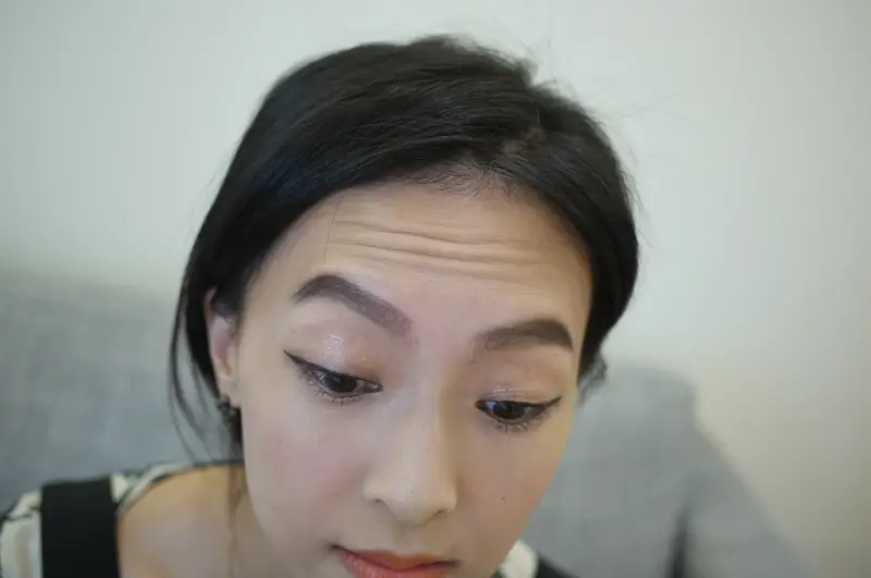 肉毒抬頭紋治療前
