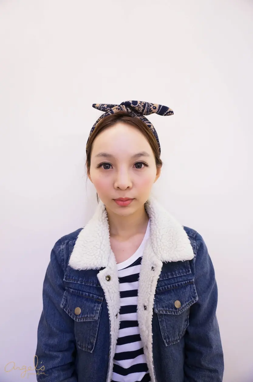 極線音波拉皮治療前