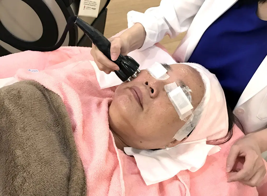 維納斯電波拉皮改善臉部線條