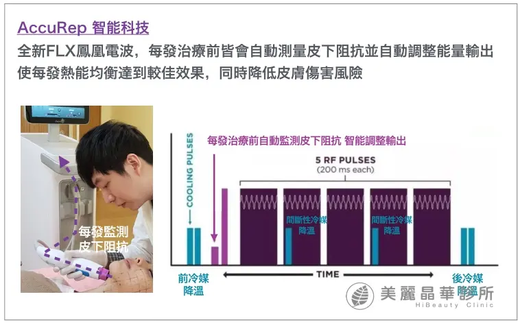 FLX鳳凰電波AccuRep智能科技熱能平均降低皮膚傷害
