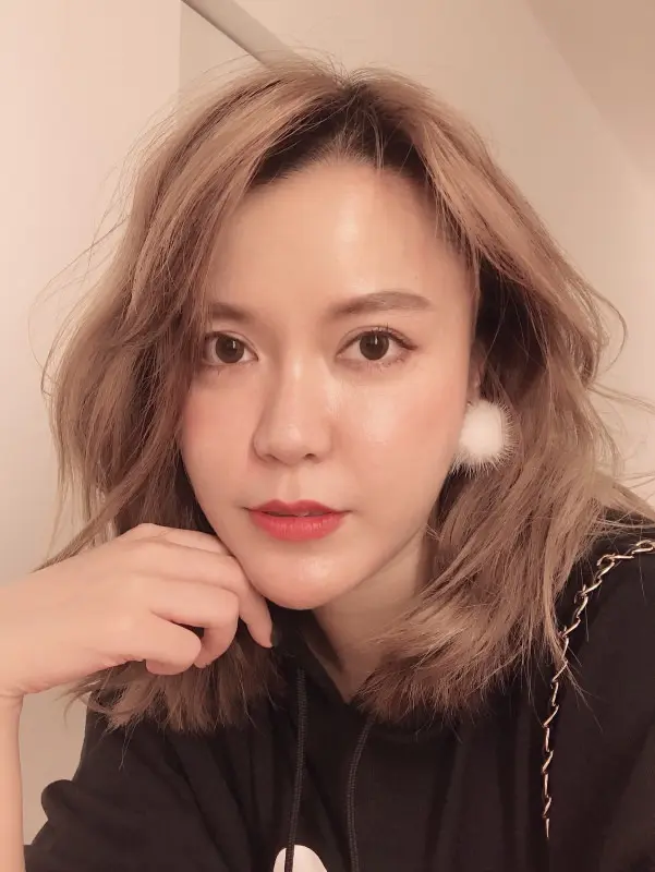 玻尿酸拉提術後臉明顯變V