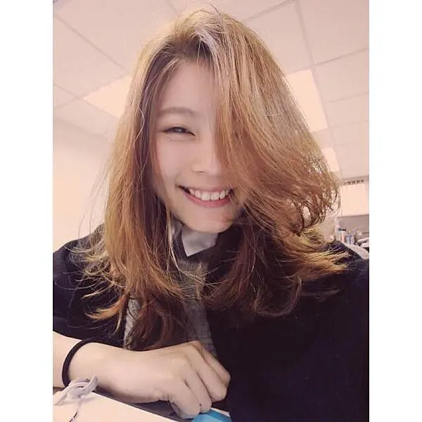 肉毒抬頭紋治療後