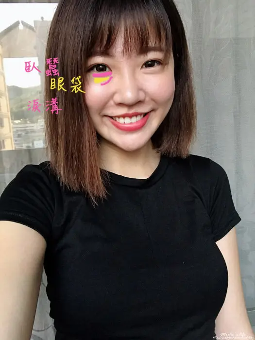 分辨臥蠶眼袋淚溝