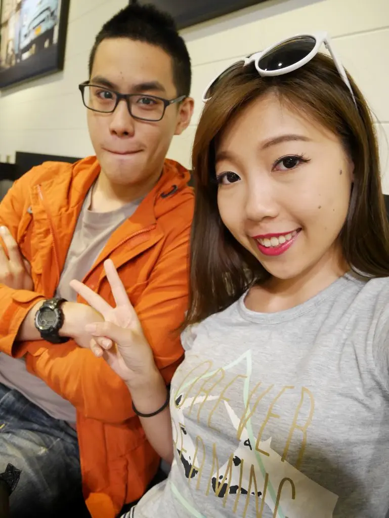 玻尿酸淚溝治療前