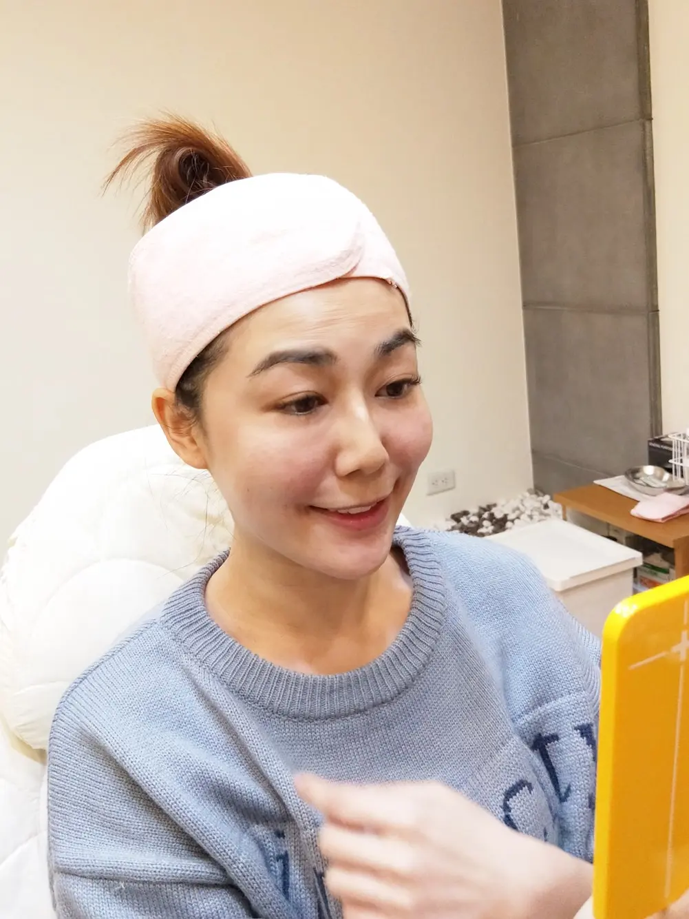 玻尿酸淚溝治療前