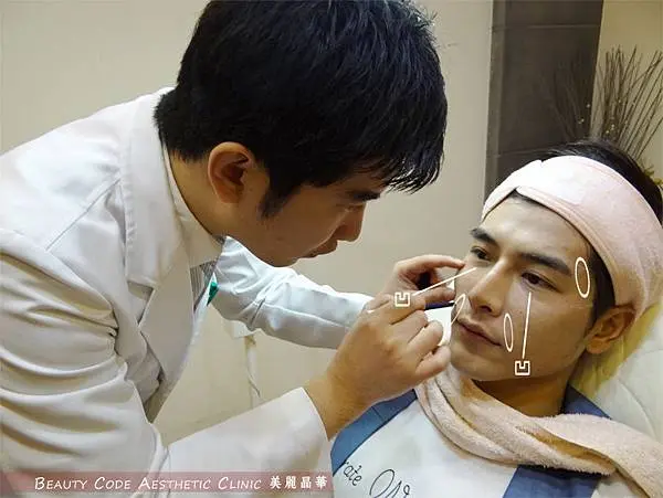 3D聚左旋乳酸術前陳志龍醫師專業標記下針位置