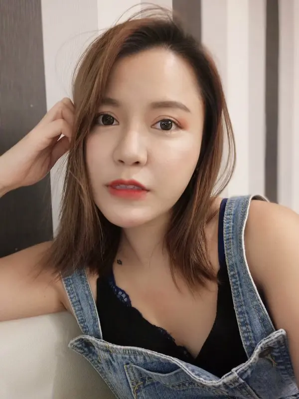 玻尿酸拉提術後