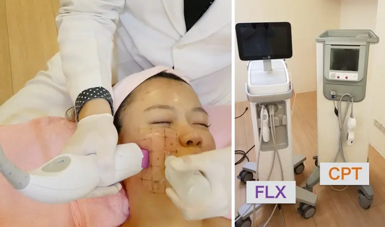 FLX鳳凰電波拉皮與CPT比較