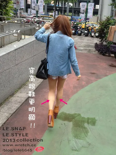 肉毒瘦小腿術前小腿肌肉發達