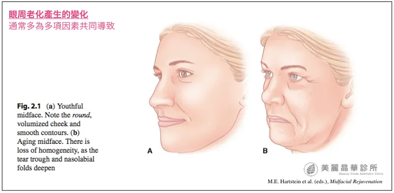眼周老化產生的變化