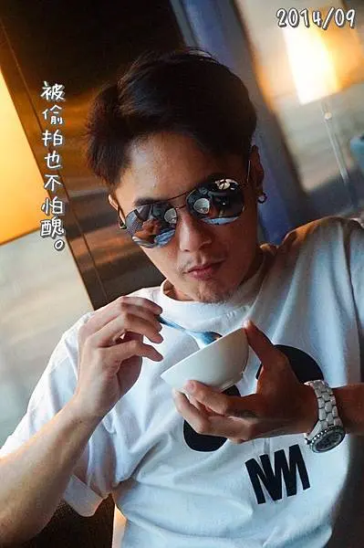 肉毒瘦臉術後