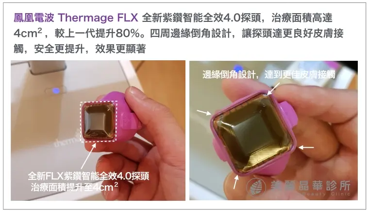FLX鳳凰電波拉皮全新紫鑽智能探頭