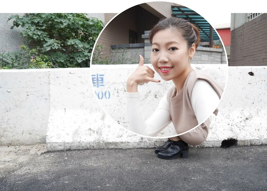玻尿酸淚溝治療前