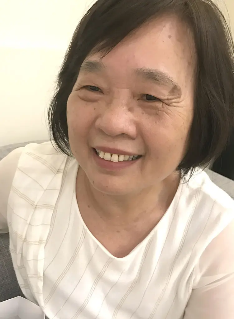 紅寶石除斑雷射