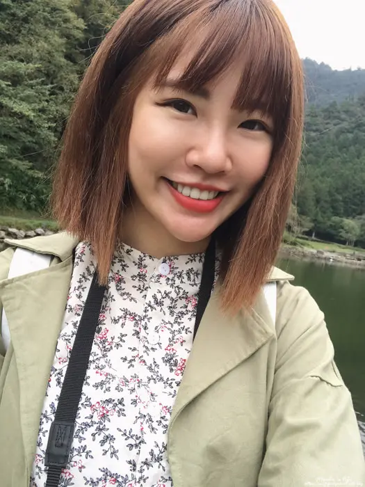 玻尿酸法令紋淚溝術後