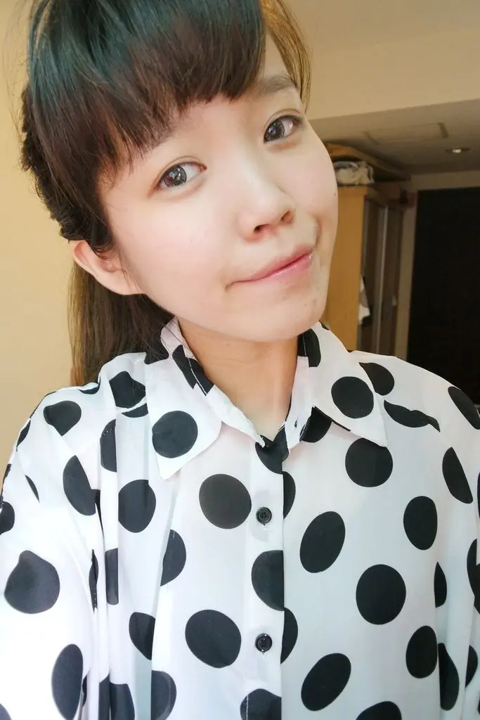 3D聚左旋乳酸術後兩個月