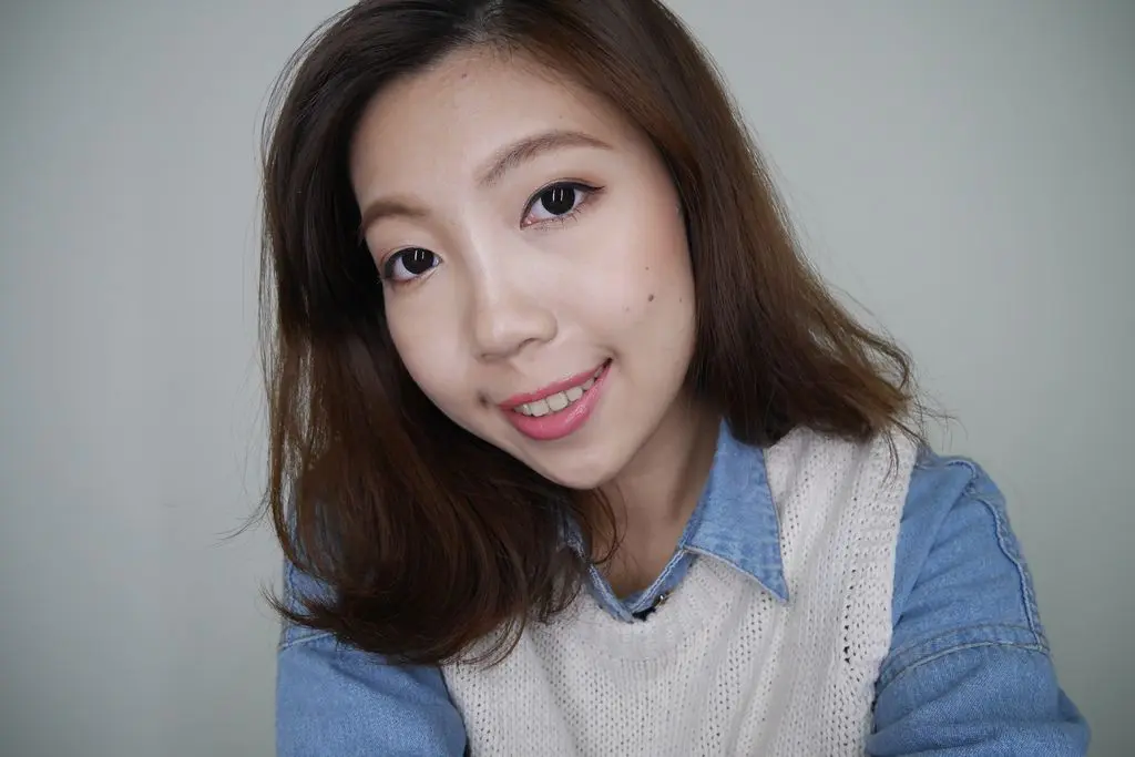 玻尿酸淚溝術後