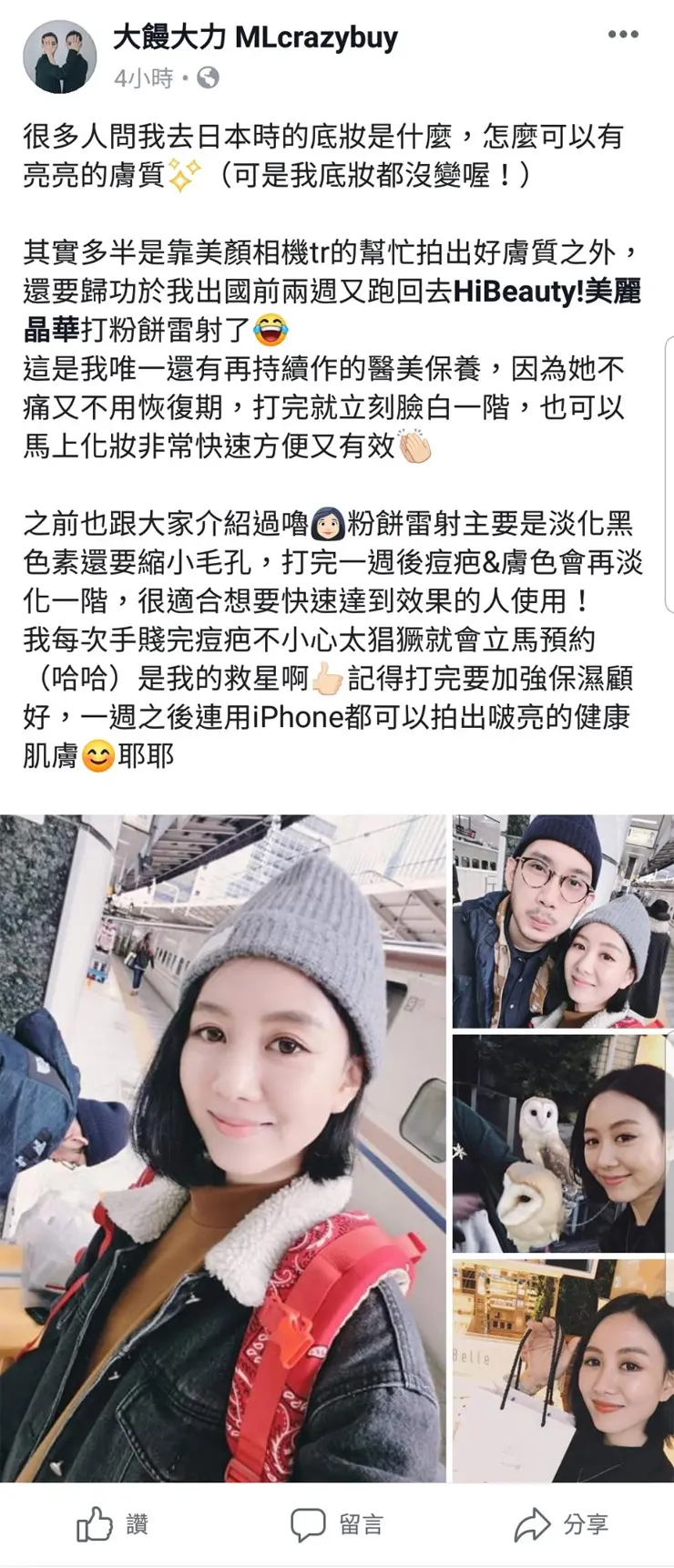 德國光纖粉餅雷射知名網路名人大饅大力治療分享推薦
