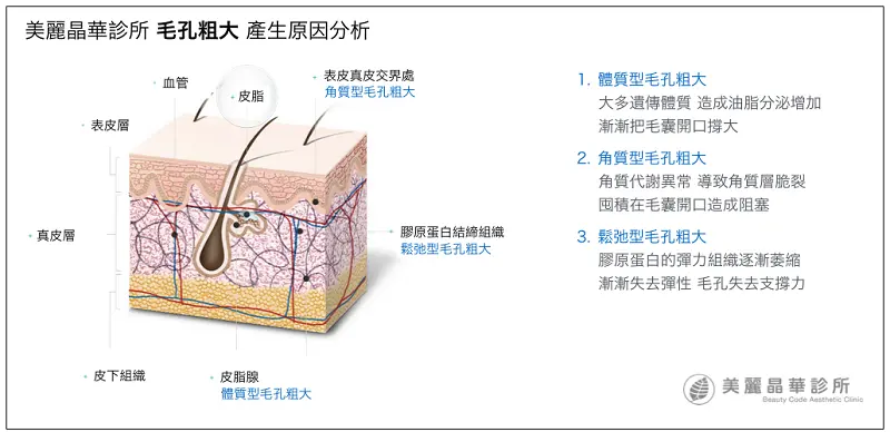 毛孔粗大產生原因分析
