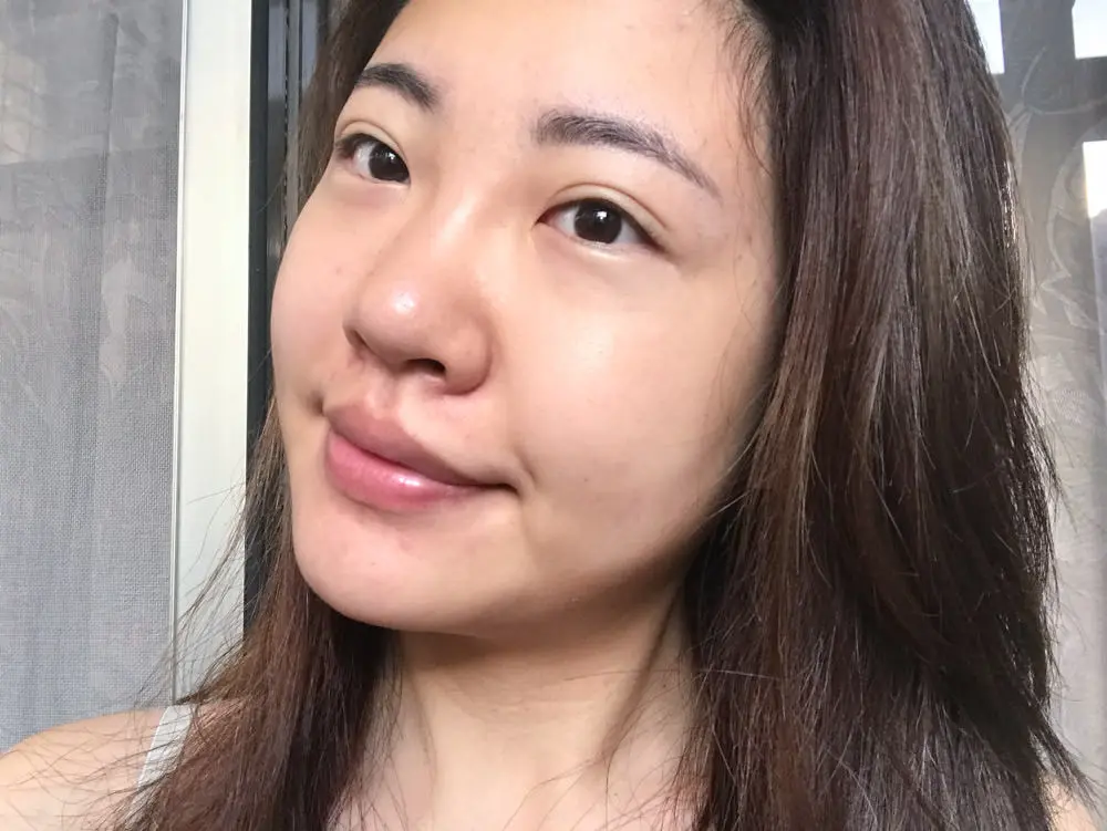 皮秒雷射推薦