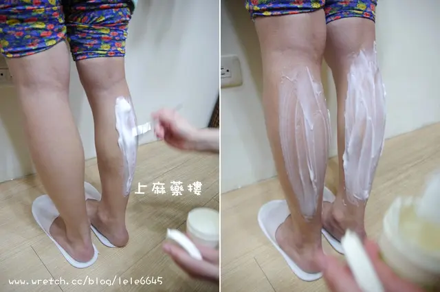 肉毒瘦小腿術前敷上麻藥