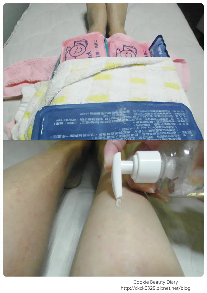 雷射除毛術後冰敷
