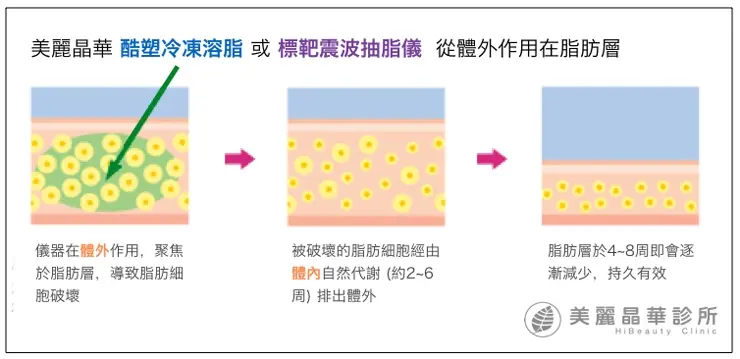 雙機體外溶脂作用原理