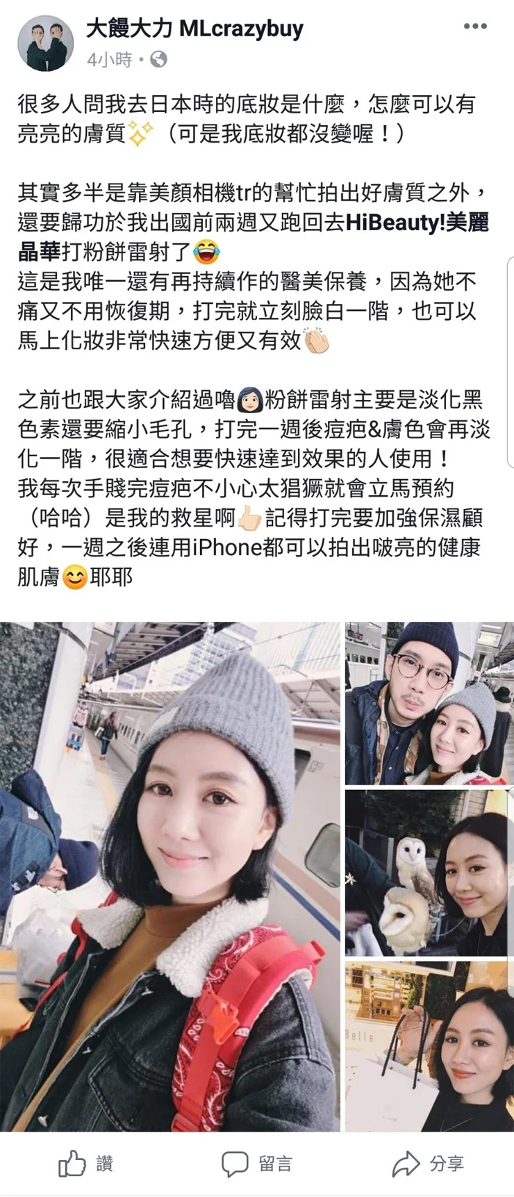 德國光纖粉餅雷射知名網路名人大饅大力治療分享推薦