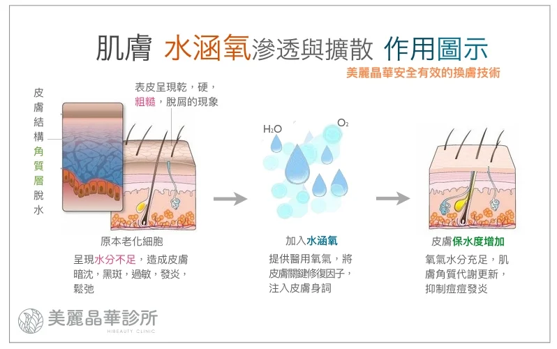 水涵氧微雕煥膚作用原理
