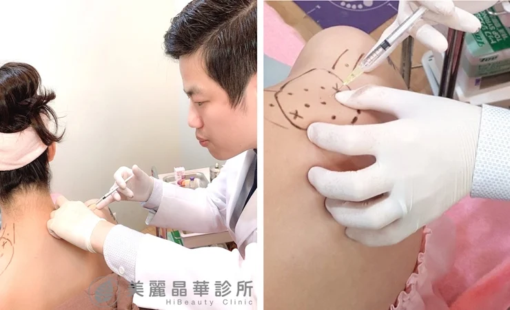 瘦肩治療專用極細針頭