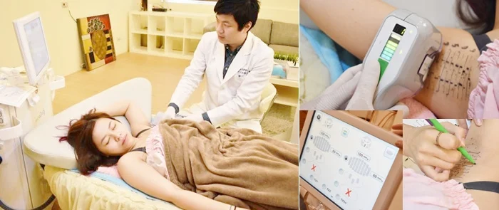 miraDry腋淨爽眾多網路名人推薦分享