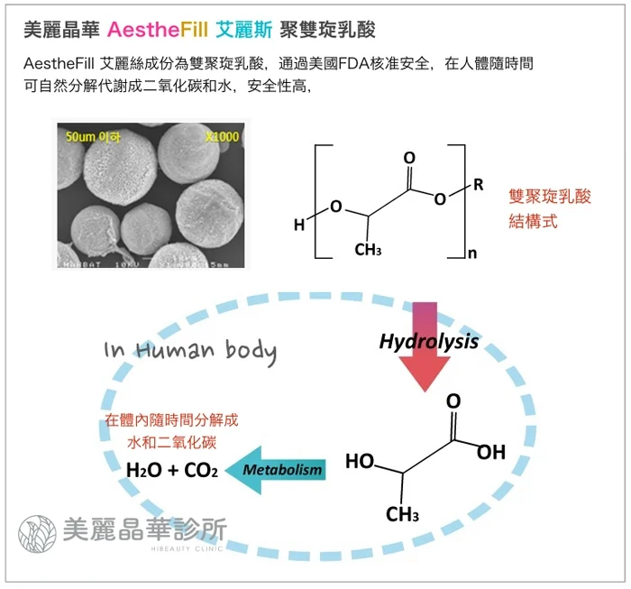 艾麗斯Aesthefill聚雙旋乳酸