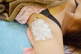 miraDry腋淨爽術後擦藥冰敷