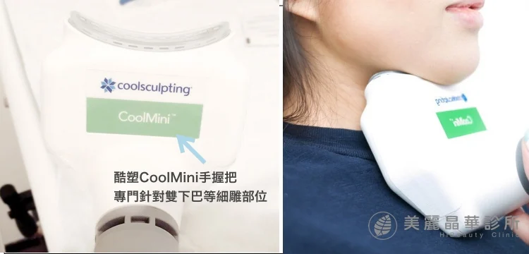 酷塑冷凍減脂針對雙下巴脂肪創新專用Coolmini手握把