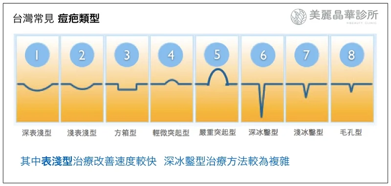 台灣常見痘疤類型