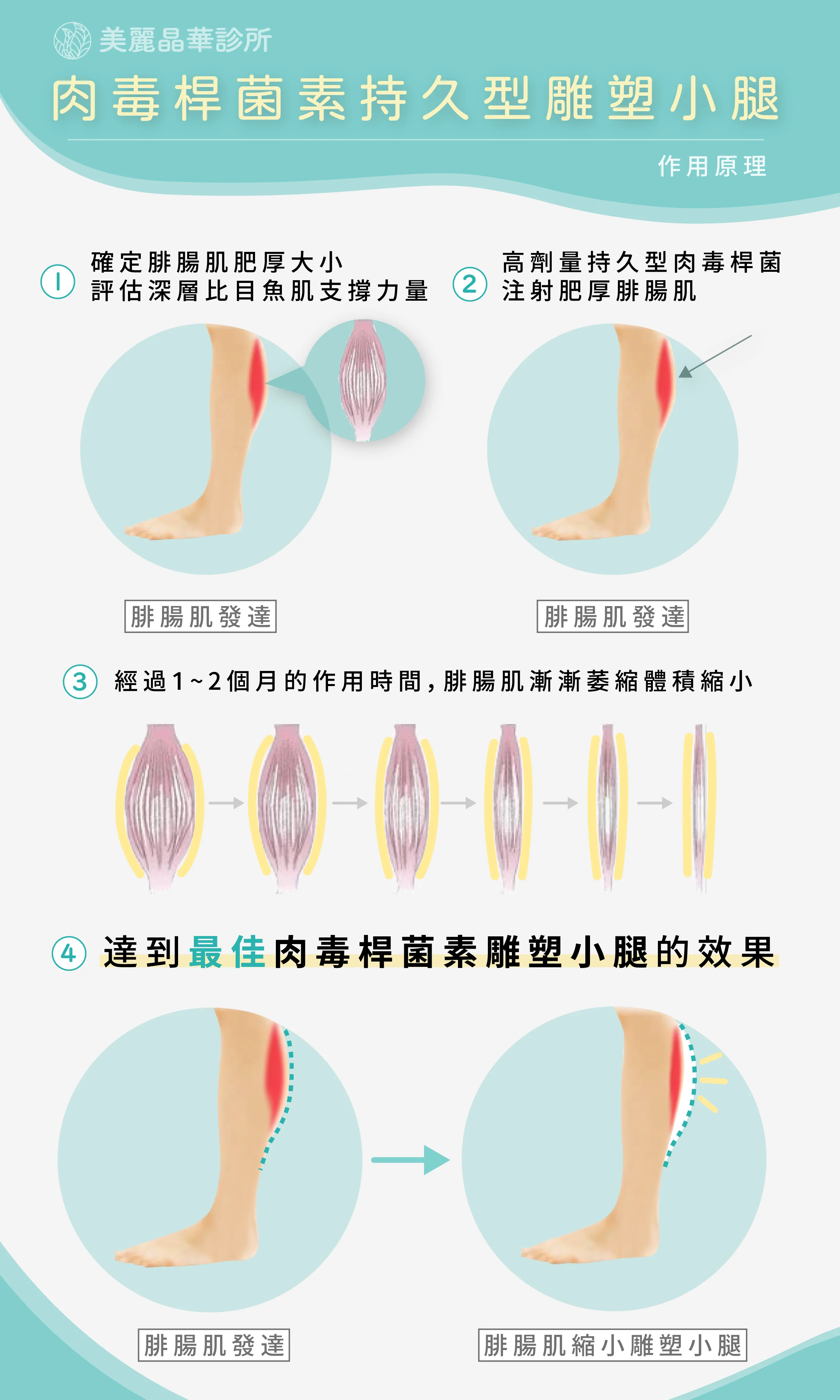 肉毒小腿 瘦小腿 持久