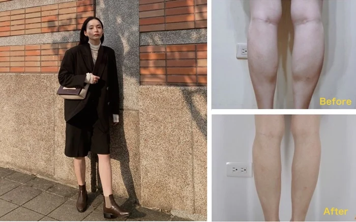 肉毒小腿 瘦小腿 名人推薦