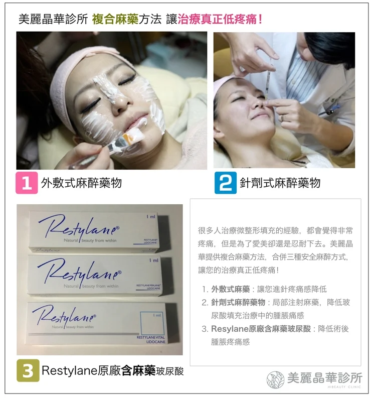 玻尿酸微整形複合式麻藥法