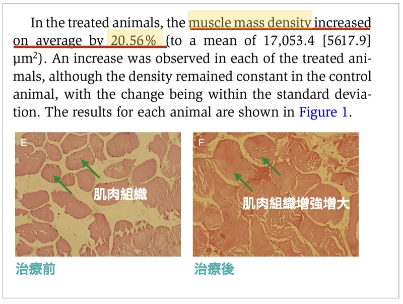 EMSELLA幸福G動椅骨盆底肌群肌力收縮力增加