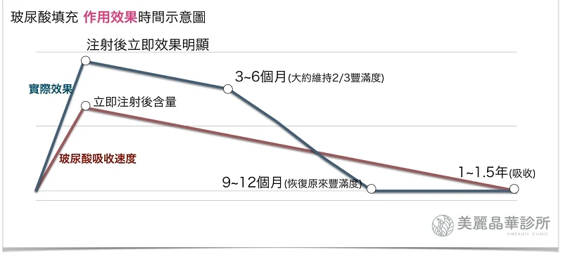 玻尿酸填充作用效果示意圖