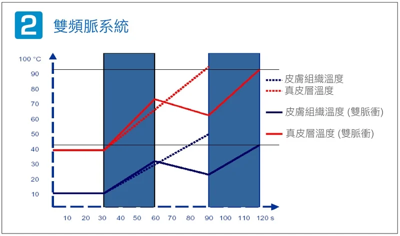 德國光纖粉餅雷射優勢-雙頻脈系統