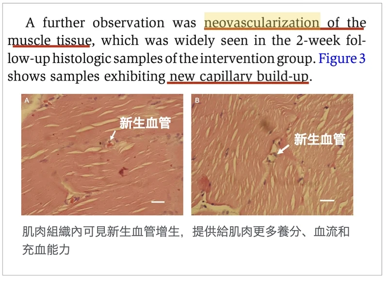 EMSELLA幸福G動椅治療後可見新生血管