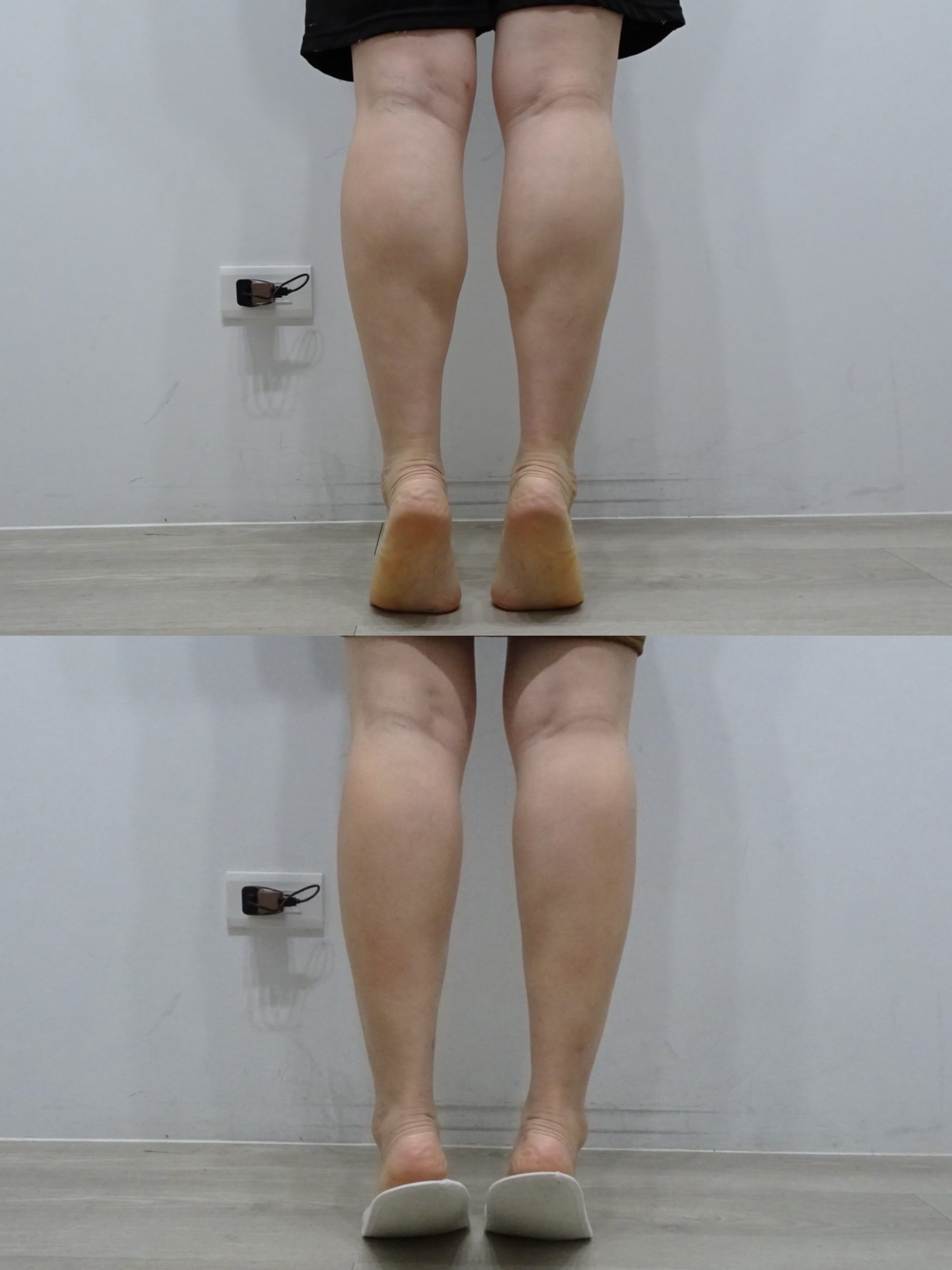 小腿對比